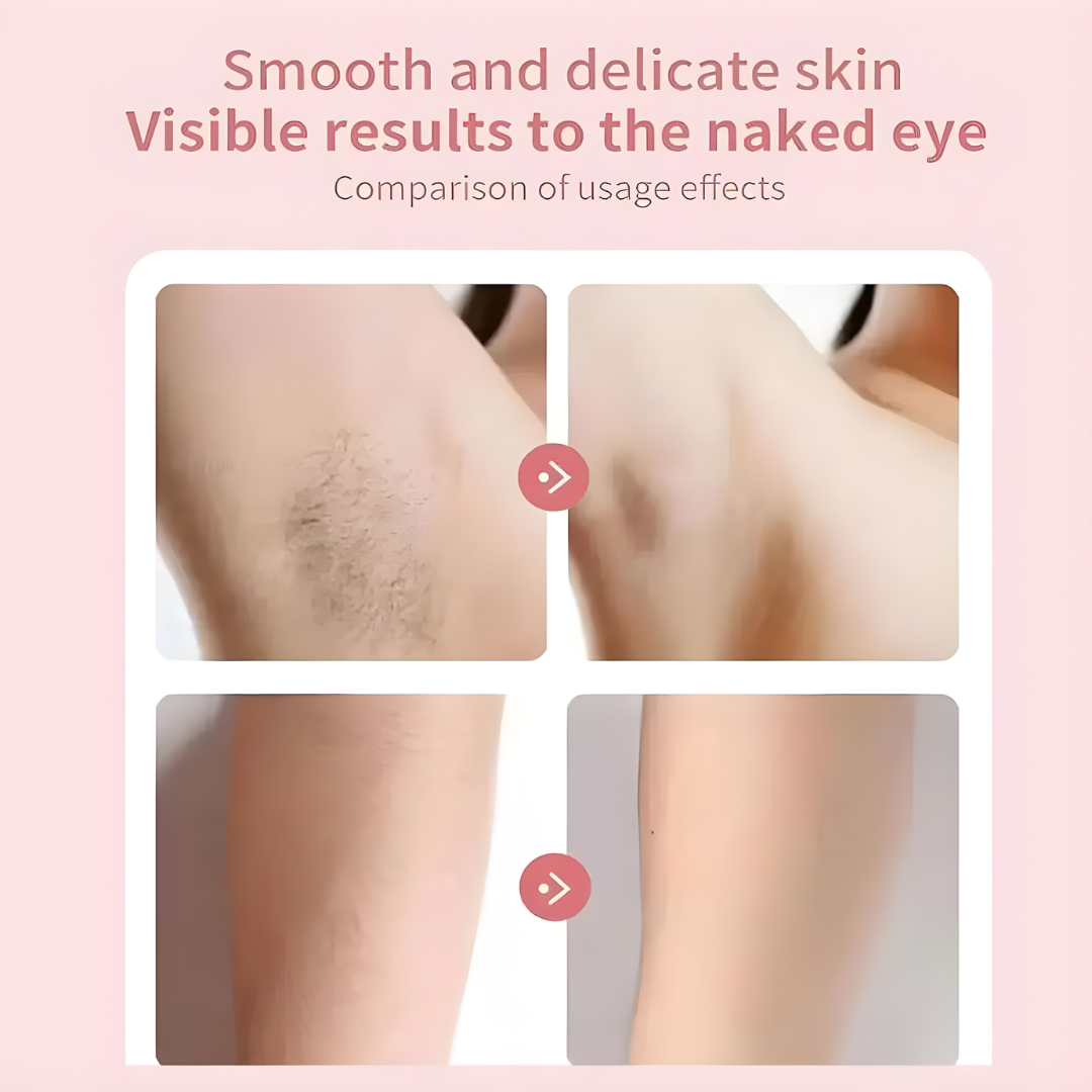 HairRemover: Oppladbar Epilator Smertefri Elektrisk Hår Fjerning Enhet