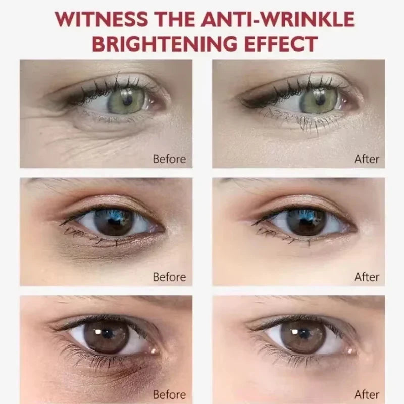 EyeCream 1+1 GRATIS: Hydrerende Oppstrammende Anti-Mørke Ringer Øye Krem Serum