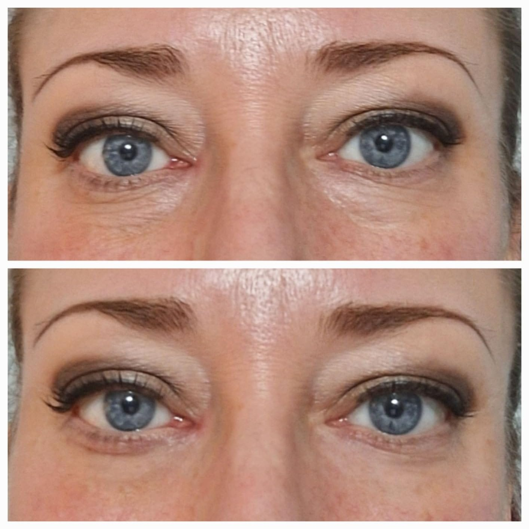 EyeCream 1+1 GRATIS: Hydrerende Oppstrammende Anti-Mørke Ringer Øye Krem Serum