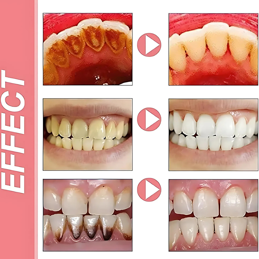 ProbioticToothpaste 1+1 GRATIS: Mild Hvitende Styrkende Probiotisk Tannkrem