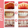 ProbioticToothpaste 1+1 GRATIS: Mild Hvitende Styrkende Probiotisk Tannkrem