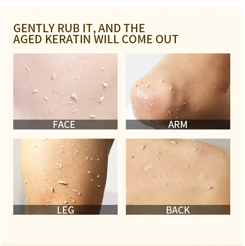 ExfoliatingGel 1+1 GRATIS: Orange Eksfolierende Gel Mild Død Hud Fjerner