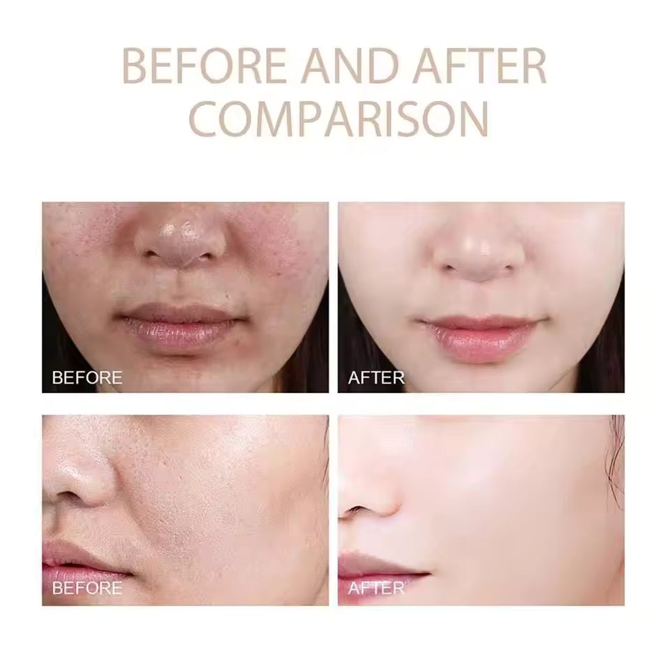 ExfoliatingSerum 1+1 GRATIS: Enkel Å Bruke Myk Eksfolierende Ampulle For Sensitiv Hud