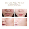 ExfoliatingSerum 1+1 GRATIS: Enkel Å Bruke Myk Eksfolierende Ampulle For Sensitiv Hud