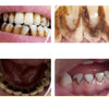 DentalCare – Lett 360° Tannpleie Verktøysett Hjemme